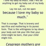 C Section quotes