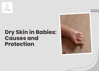 Dry Skin in Babies: Causes and Protection Dry Skin in Babies: Causes and Protection