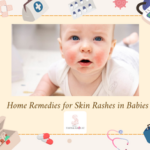 Home Remedies for Skin Rashes in Babies