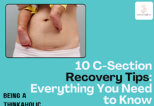 10 C-Section Recovery Tips: Everything You Need to Know 10 C-Section Recovery Tips: Everything You Need to Know10 C-Section Recovery Tips: Everything You Need to Know