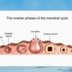 No Ovulation